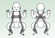 Điều trị gãy xương đùi ở trẻ sơ sinh hiệu quả, thuận tiện bằng đai PAVLIK